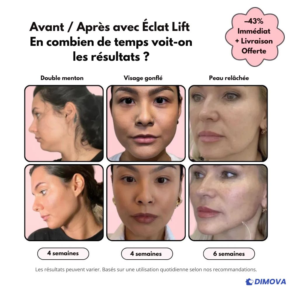 Éclat Lift - Rajeunit visiblement la peau en 30 jours