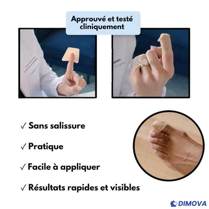 Pansements antimycosiques pour la nuit (Boîte de 60 pansements)