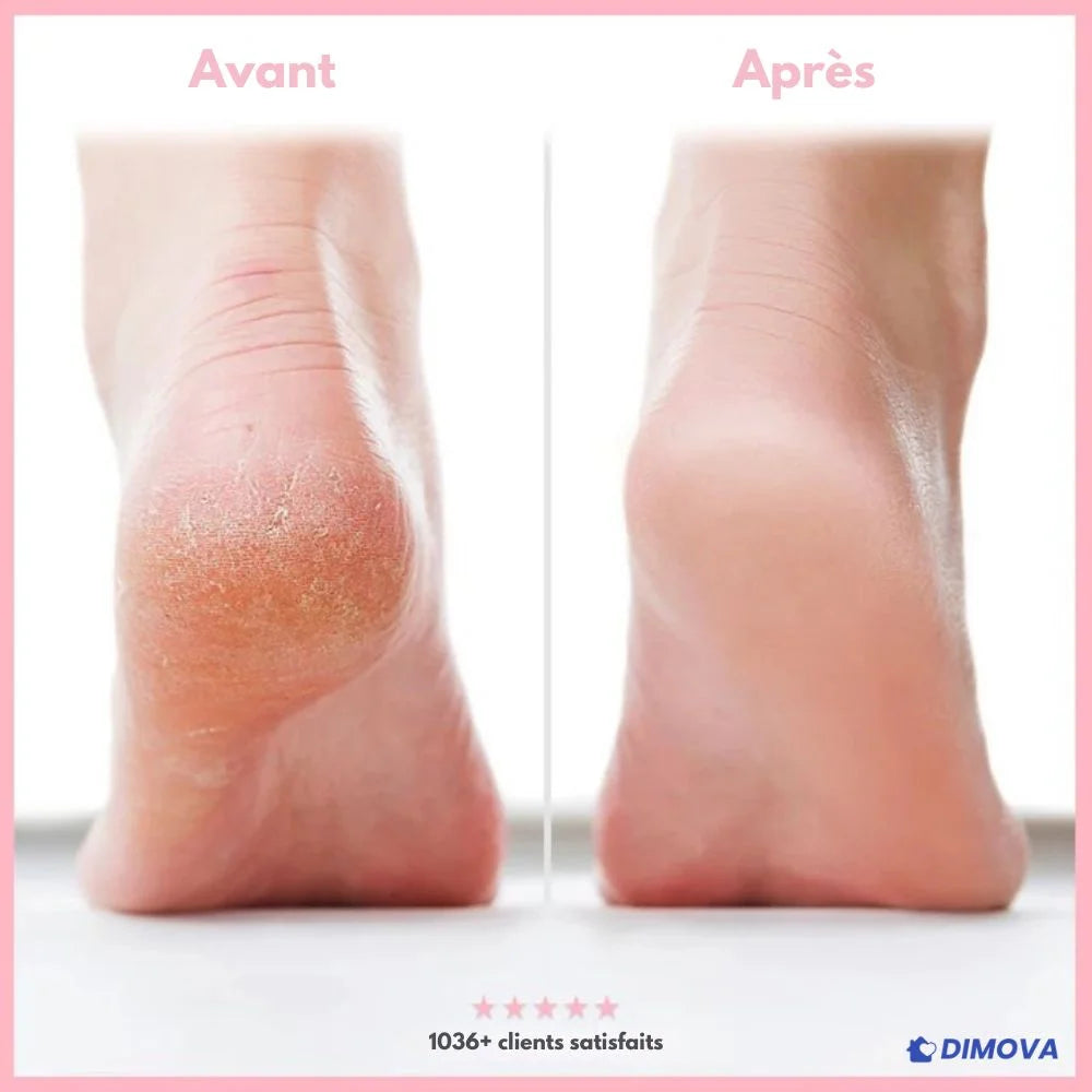 Râpe pédicure pieds – Des talons doux sans effort