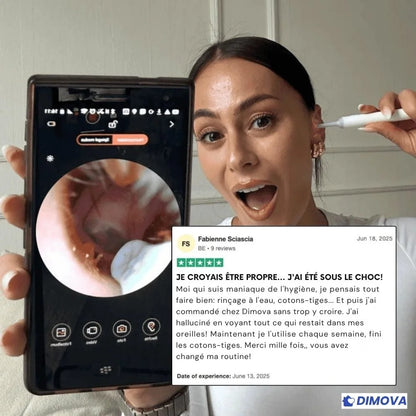 Otoscope - Nettoyeur d'oreille avec caméra intéfrée