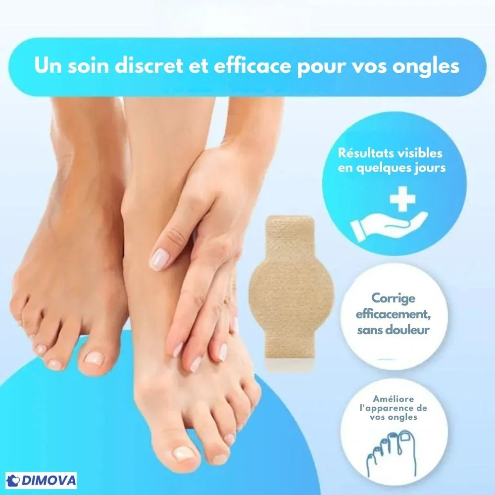 DIMOVA® – Patchs anti-mycoses efficaces et discrets