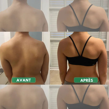 Correcteur de posture instantané