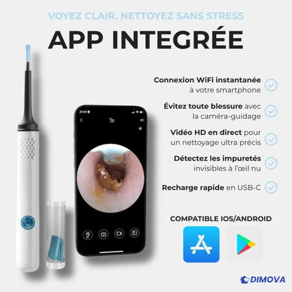 Otoscope - Nettoyeur d'oreille avec caméra intéfrée